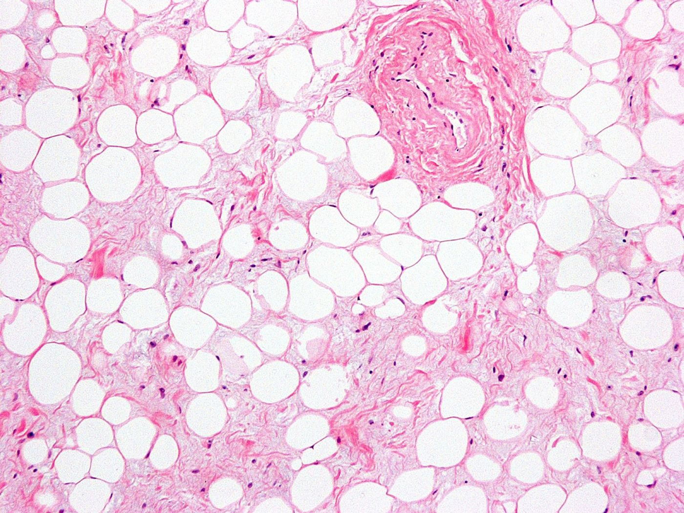Adipose tissue