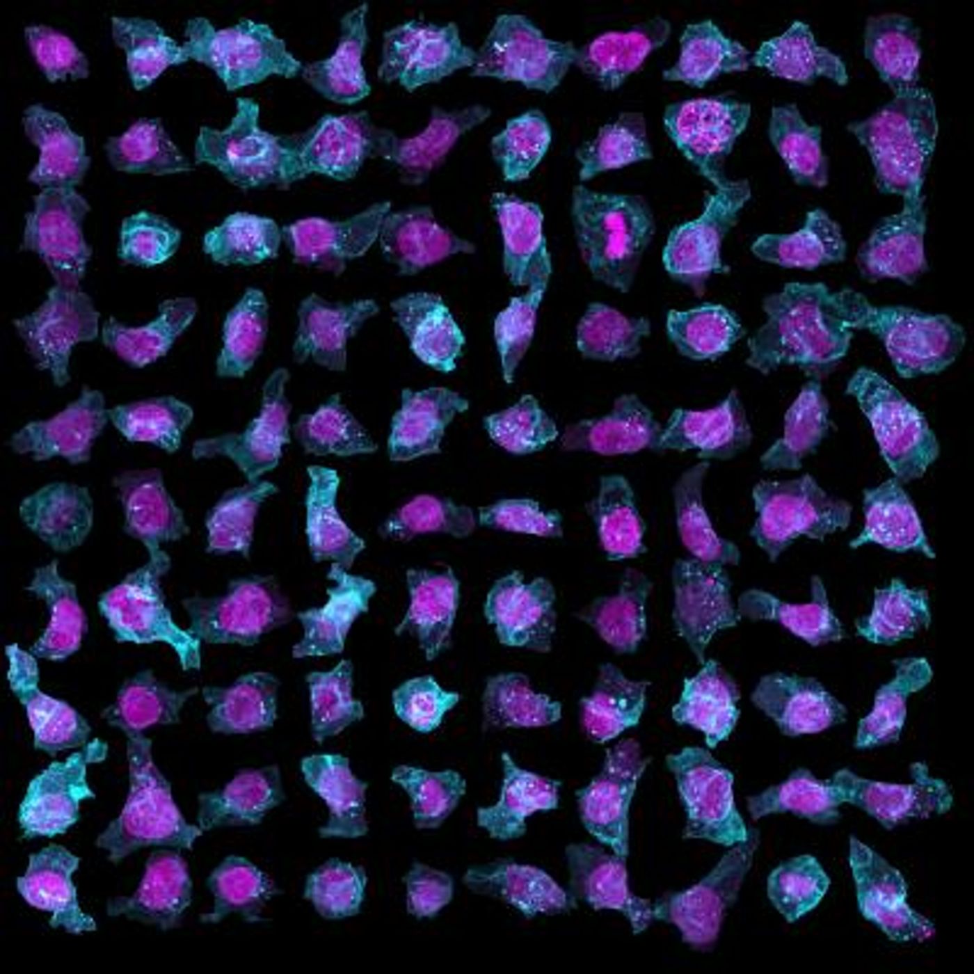 Allen Institute researchers have found astonishing variability of the intracellular organization inside human stem cells -- even among cells that are clones of one another. Here is a sample of 100 cells from the Allen Cell Explorer showcasing that variability. Each structure is color labeled: magenta -- DNA, cyan -- cell membrane. / Credit: Allen Institute for Cell Science