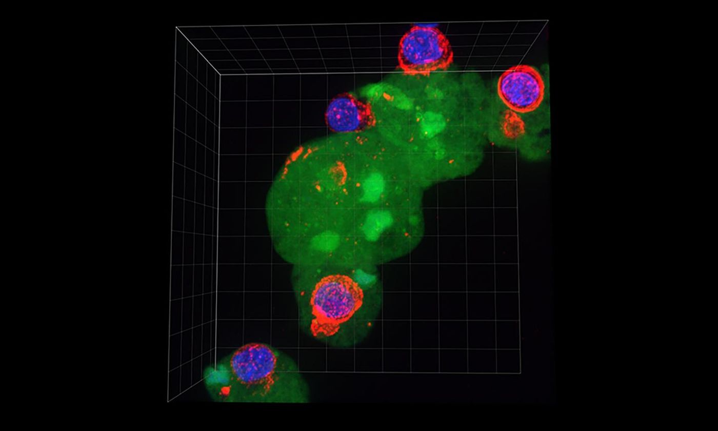 This image shows amoebae (green) attacking human cells and displaying human proteins (red) on their surface. / Credit: Hannah Miller/UC Davis