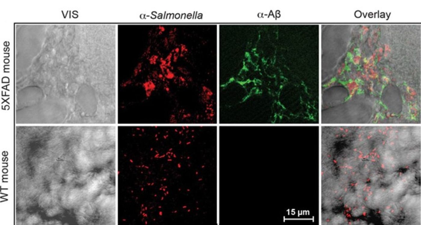 Infection-induced ?-amyloid deposits colocalize with Salmonella in AD mouse brain.