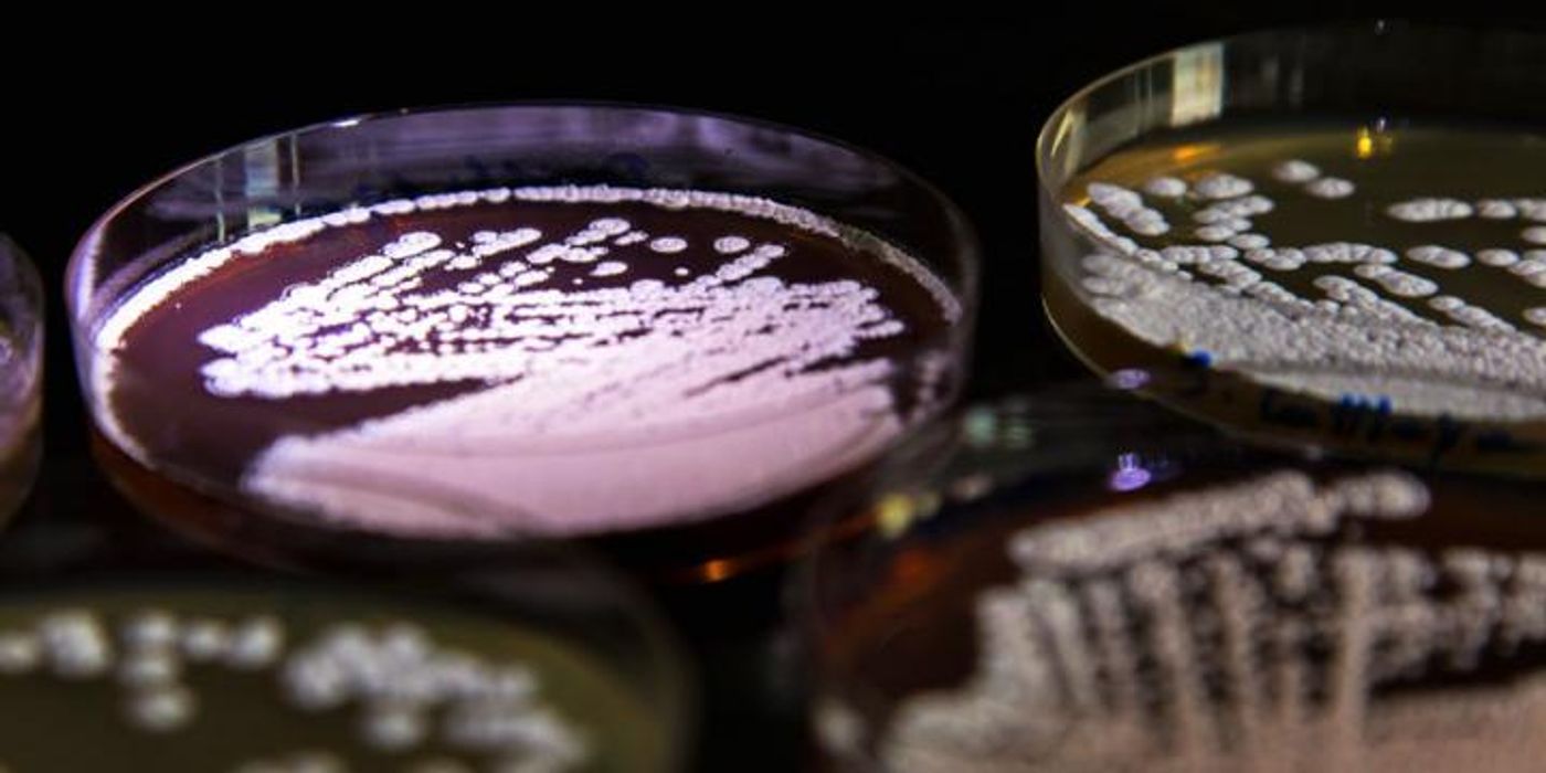 Actinomycetes is in a plate. / Credit: DTU/DTU Biosustain