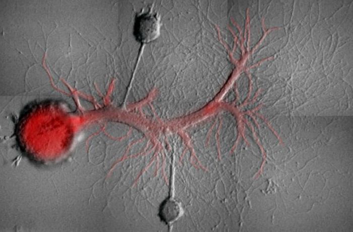 Two Aplysia sensory neurons with synaptic contacts on the same motor neuron in culture after isolation from the nervous system of Aplysia. The motor neuron has been injected with a fluorescent molecule that blocks the activity of a specific Protein Kinase M molecule. / Credit: Schacher Lab/Columbia University Medical Center