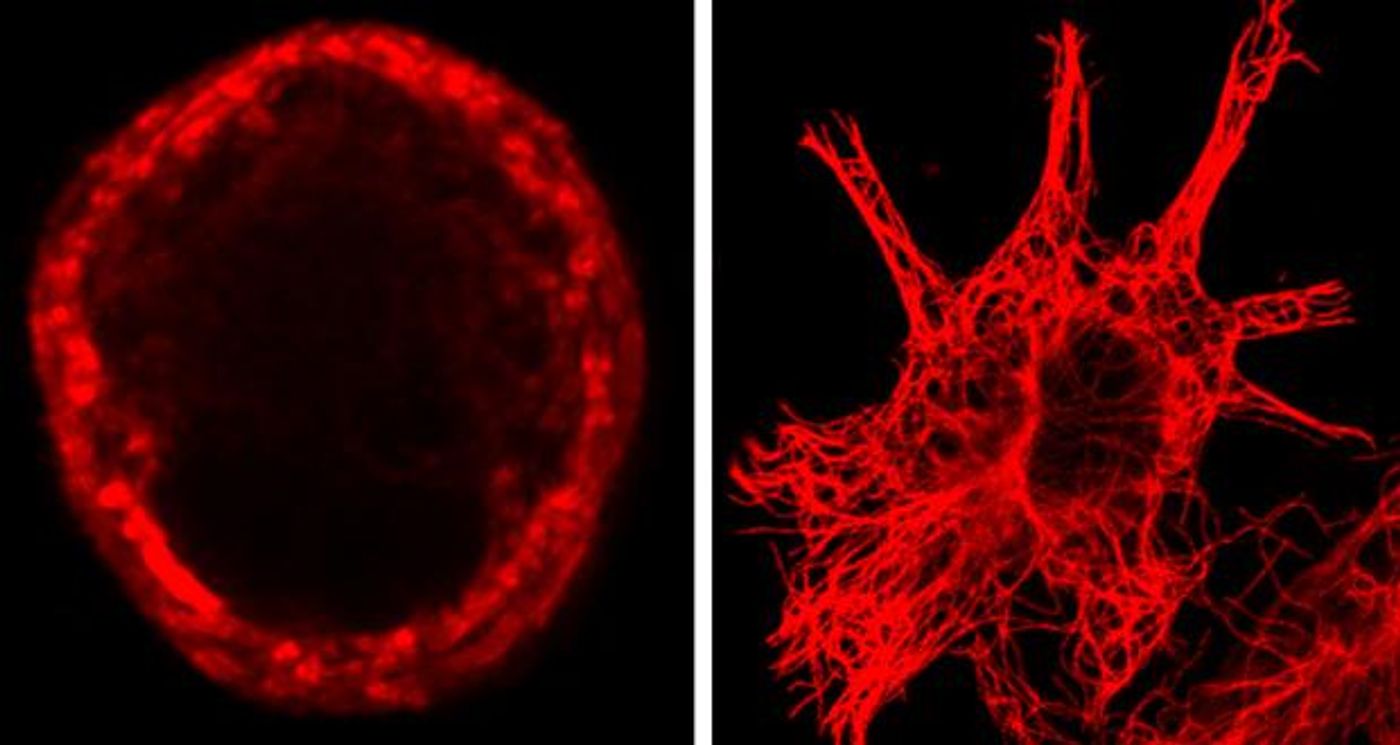 In sensory cells (left), microtubules form a ring just below the cell membrane. In other cells (right), they don't. / Credit: Shane Morley/EMBL