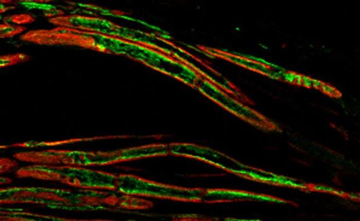 Microtubules (green) lie just below the membrane of sensory neurons (red), keeping the cells bendy enough to sense touch and pain. / Credit: Nereo Kalebic/EMBL 
