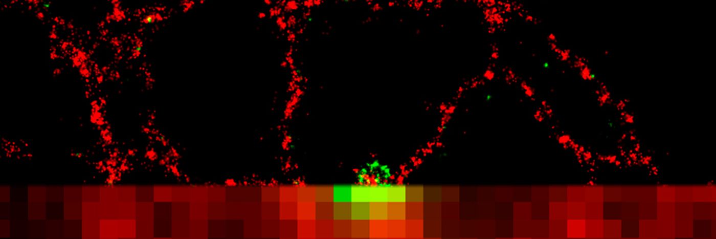 In green, the location of an autophagy-related protein involved in the early stages of autophagosome formation. In red is endoplasmic reticulum. Combined STORM and wide-field images (top) demonstrates the resolution enhancement achieved using STORM super resolution microscopy over conventional methods (bottom). / Credit: The Babraham Institute