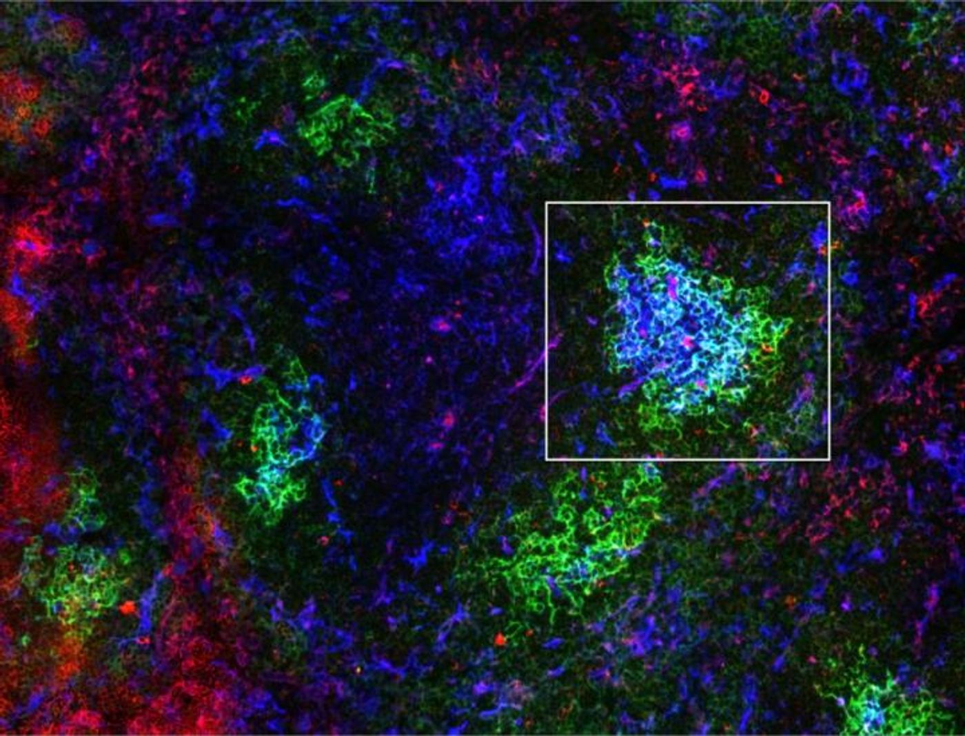 A germinal center (rectangle) in the spleen of an immunized mouse, showing inactivated GSK3 (magenta) in B cells (blue) near follicular dendritic cells (green).