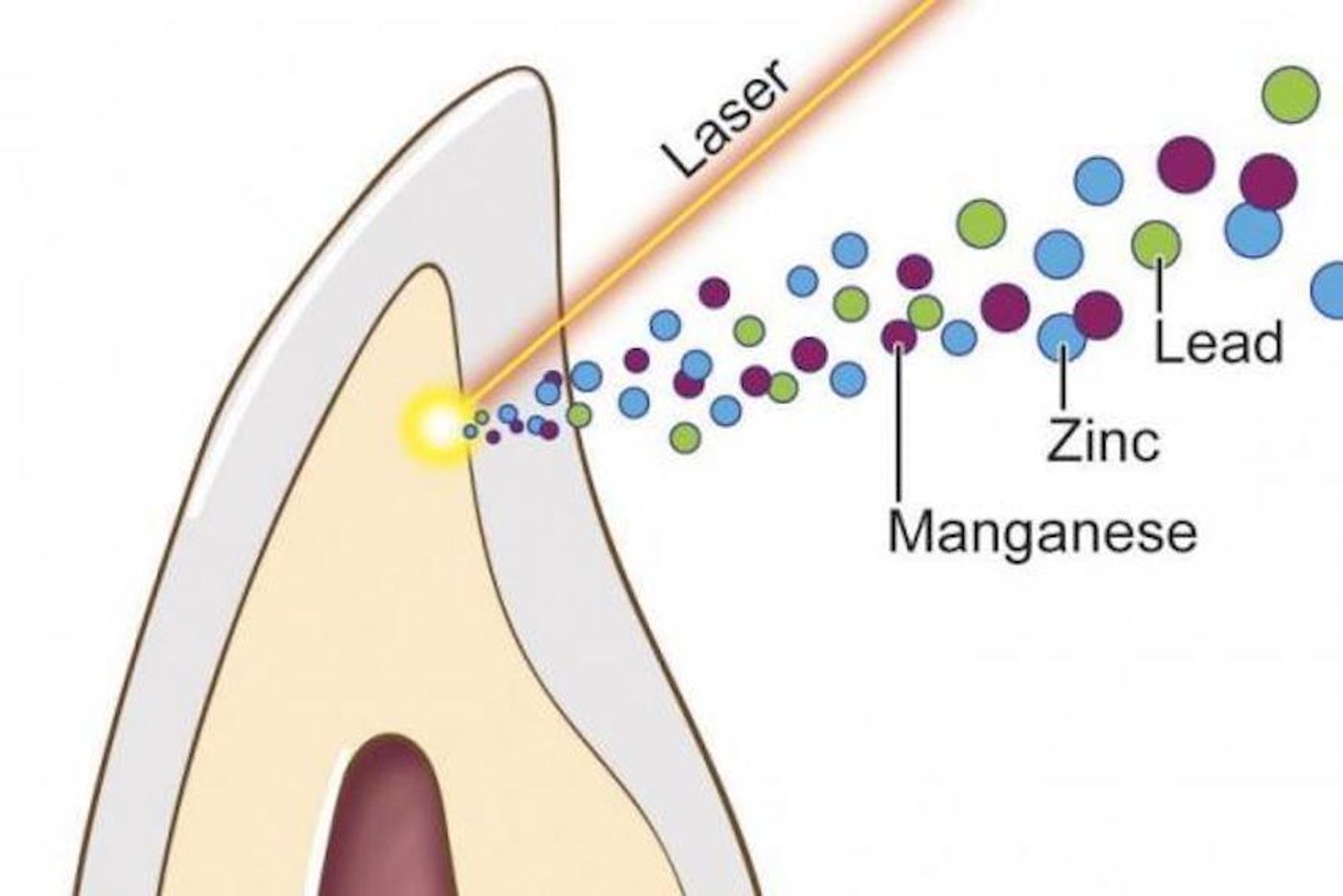 This cross-section of a tooth shows laser removal of the dentine layer, in tan, for analysis of metal content. / Credit: J. Gregory/Mount Sinai Health System