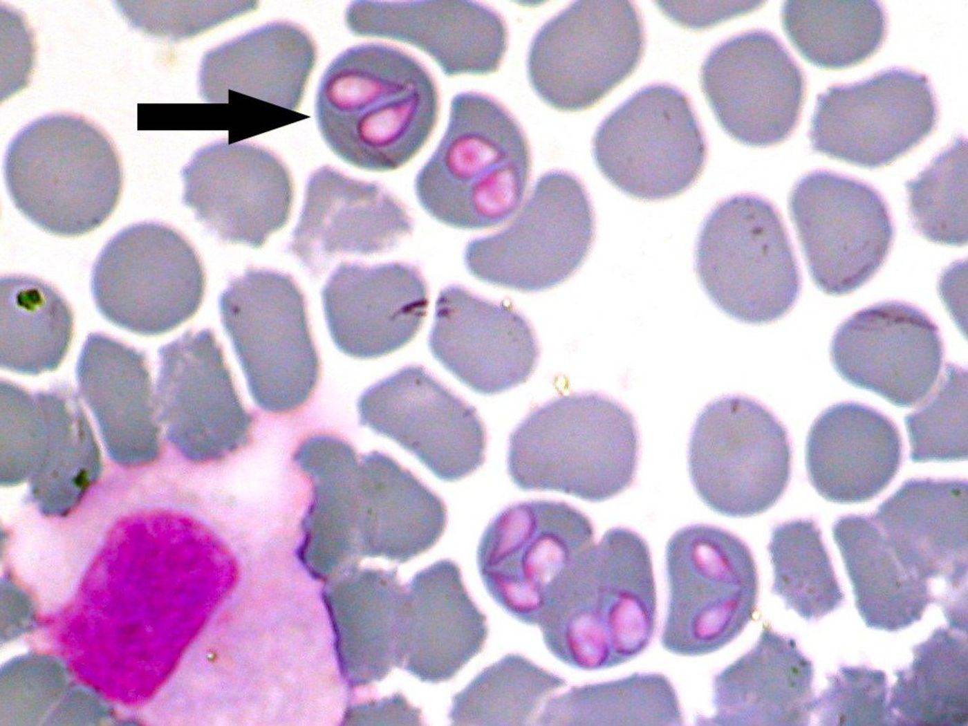 Babesia sporozoans in dog blood.