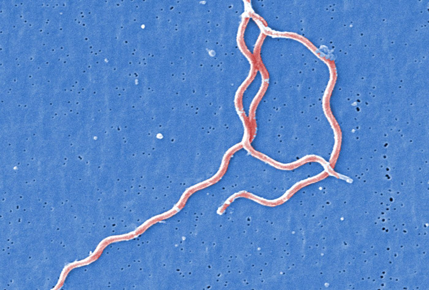 Electron micrograph of Borrelia.