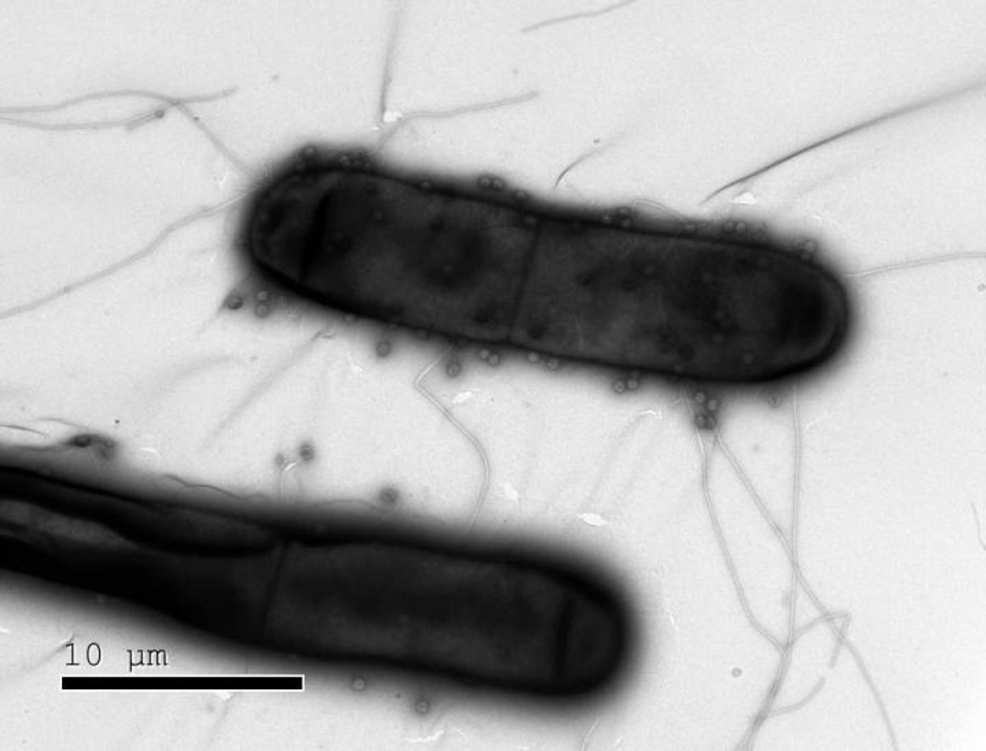 Bacteria like these have numerous defenses against the phages (dots) that infect them. / Credit: Weizmann Institute of Science
