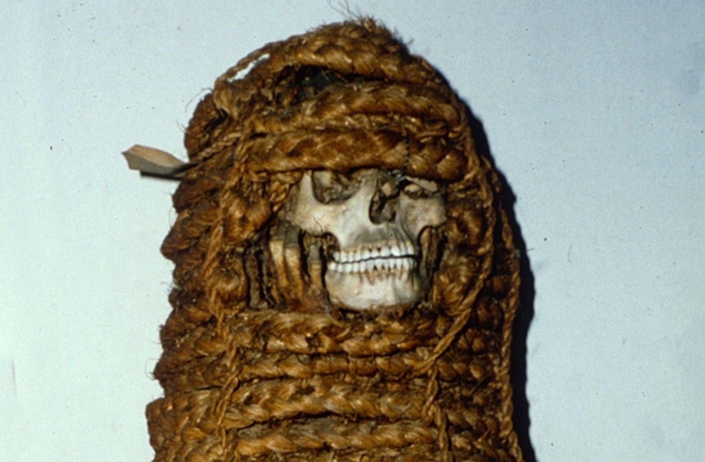 Researchers discovered antibiotic resistance genes in this mummy's microbiome.