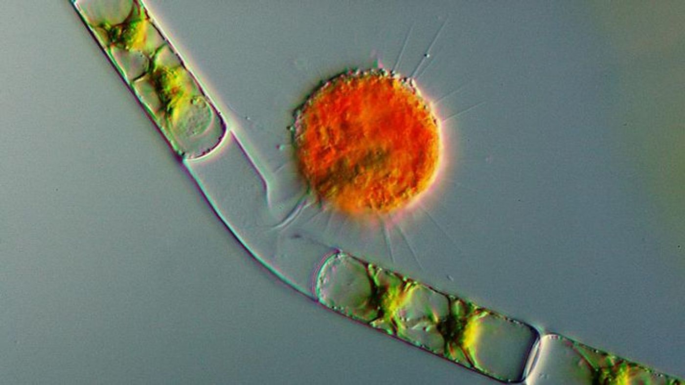 A vampire amoeba preys on green algae.