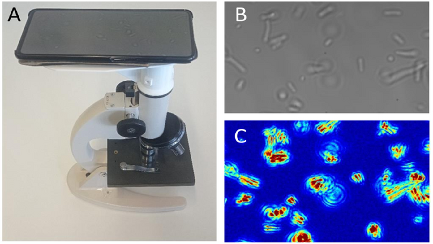 An antibiotic susceptibility test with Optical Nanomotion Detection | A: Simple setup with microscope & mobile phone | B: E. coli | C: Same field of view as B in false colors highlighting nanomotion - high amplitude motion (red) or no motion (blue) / Credit: Ines Villalba (EPFL)
