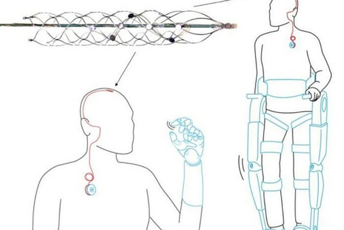 A new implantable device could control an exoskeleton