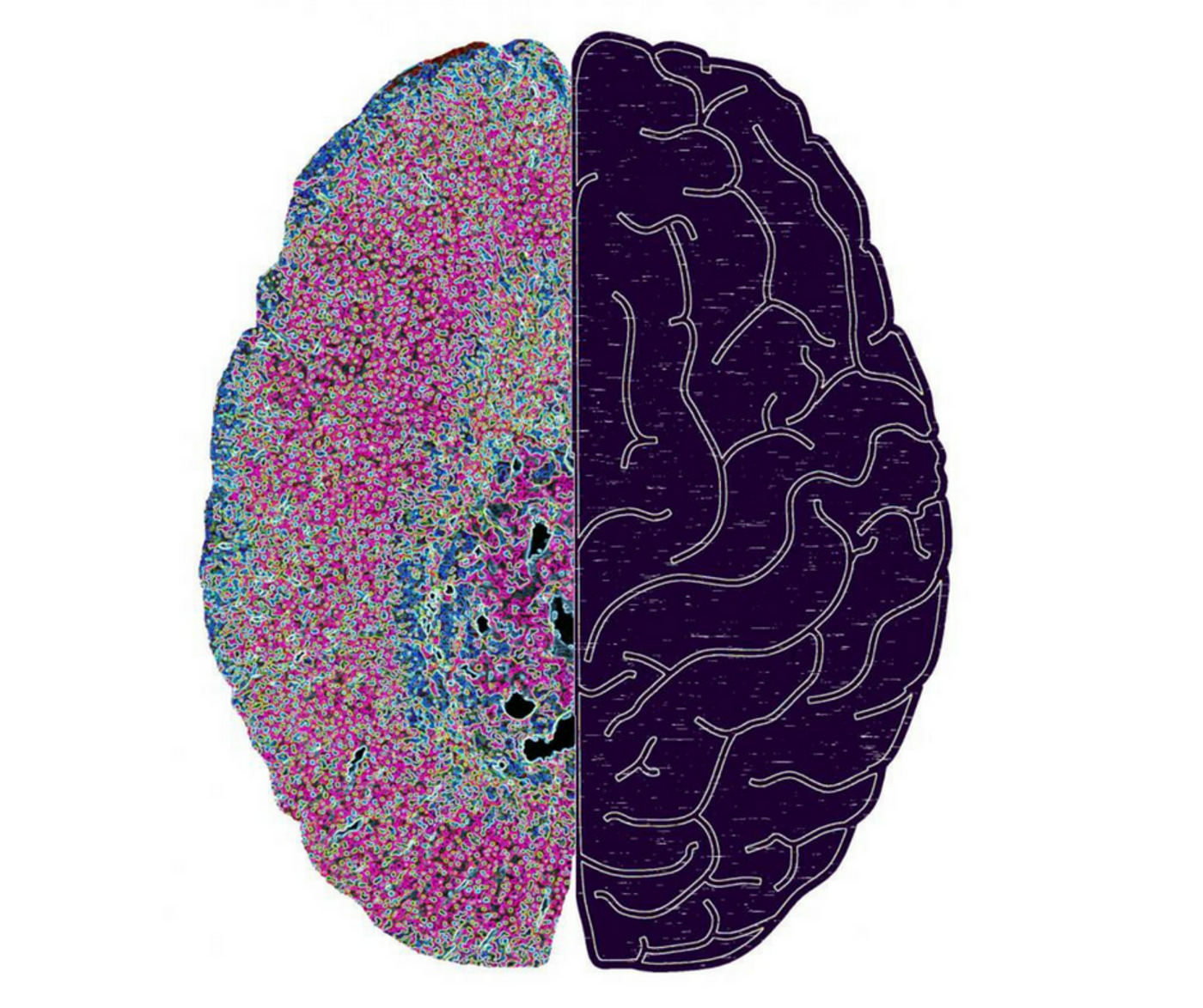 New interface between adrenal (left) and brain (right). A symbolic image for a newly discovered pathway through which the central nervous system, using the hormone production in the adrenal gland, can lead to a disorder of the immune system with severe infections. Credit: Charité - Universitätsmedizin Berlin