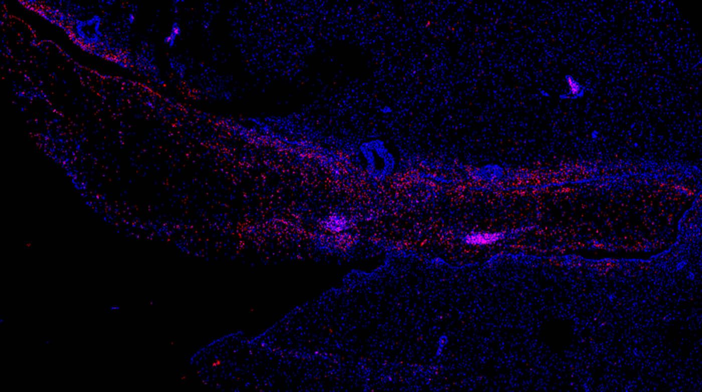 Ebola virus (red) relapses in the brain ventricular system and adjacent neuropil of a rhesus monkey  after Ebola virus exposure and treatment with monoclonal antibodies. 