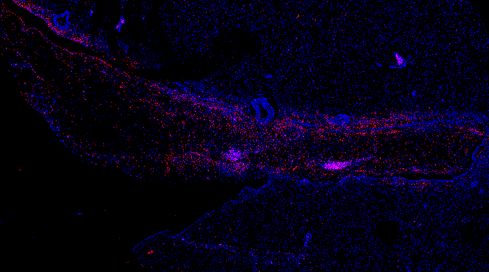 Ebola virus (red) relapses in the brain ventricular system and adjacent neuropil of a rhesus monkey  after Ebola virus exposure and treatment with monoclonal antibodies. 