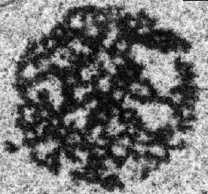 This is an electron microscopy of a cellular amyloid plaque. / Credit: Sylvester Comprehensive Cancer Center
