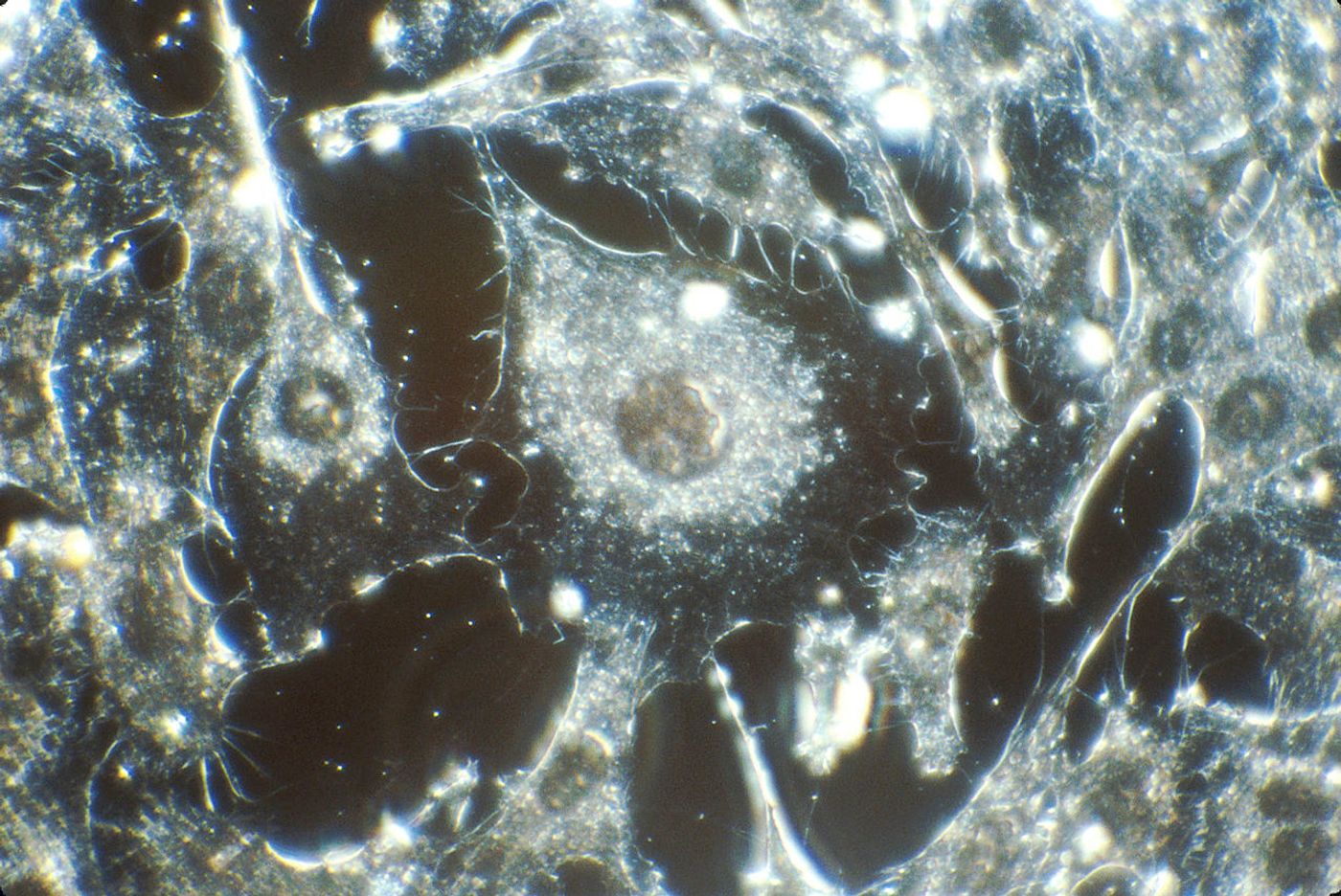 Cancer cells in tissue culture from human connective tissue, illuminated by darkfield amplified contrast, at a magnification of 500x. Source: National Cancer Institute