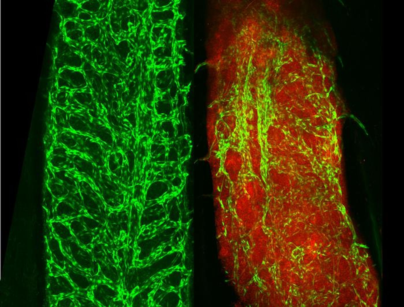 The image on the left shows blood vessels (pictured in green) in healthy bone marrow; the image on the right shows blood vessels in bone marrow that has AML (pictured in red). / Credit: WEHI