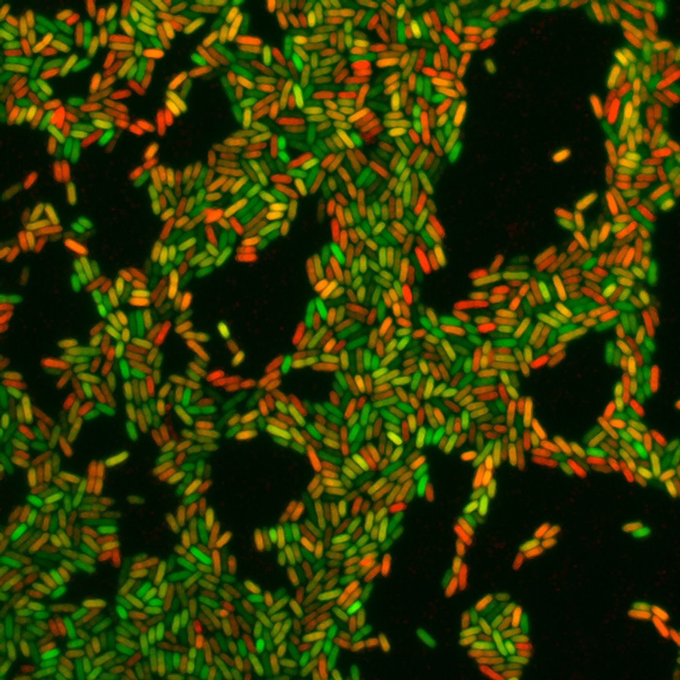 Calcium induces a switch from the acute (green) to the chronic virulence state (red) of the pathogen Pseudomonas aeruginosa./Credit: University of Basel, Biozentrum 