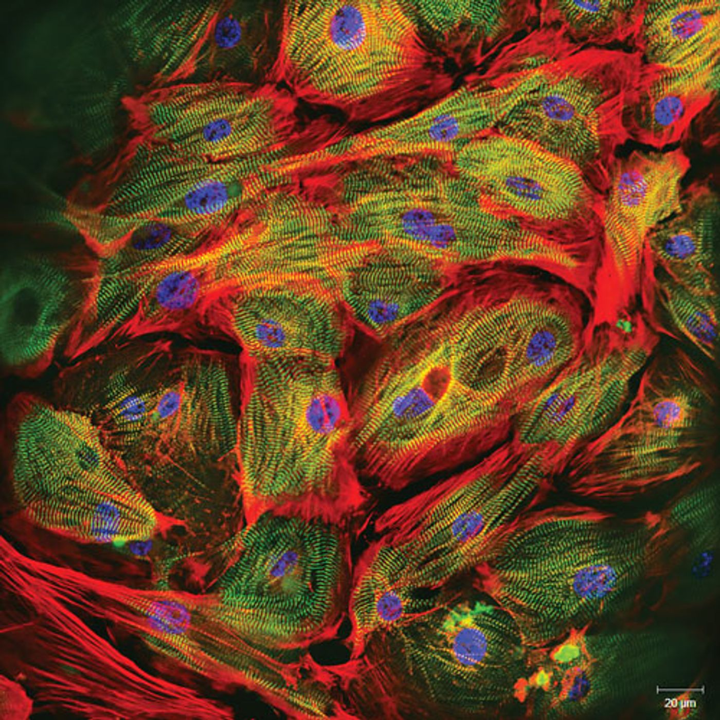 Human cardiomyocyte-derived induced pluripotent stem cells