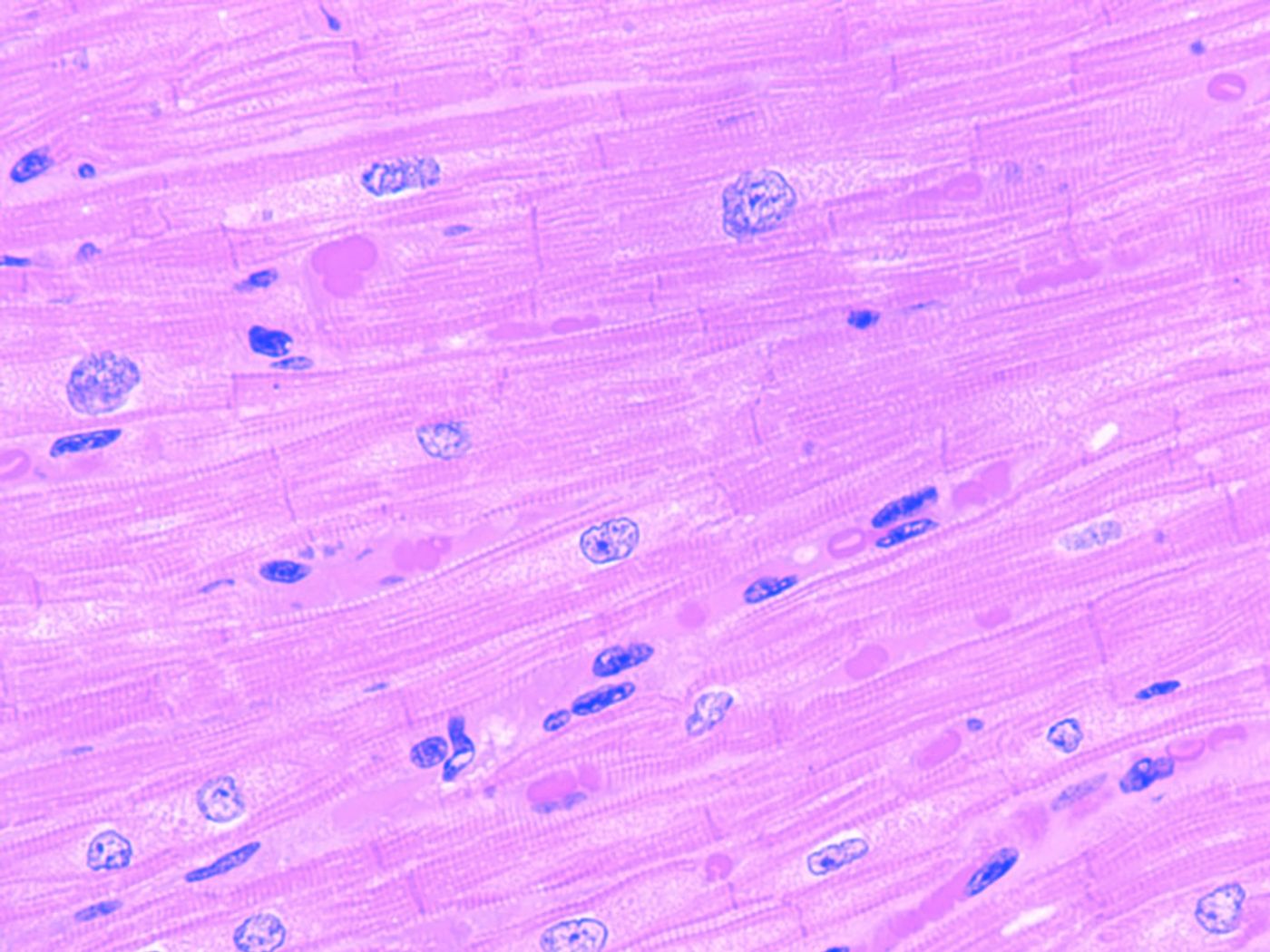 Striations of heart muscle cells