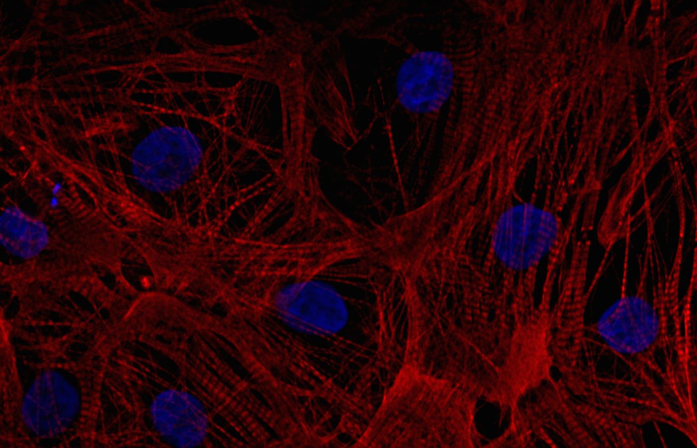Cardiomyocytes. Source: Axol Bioscience