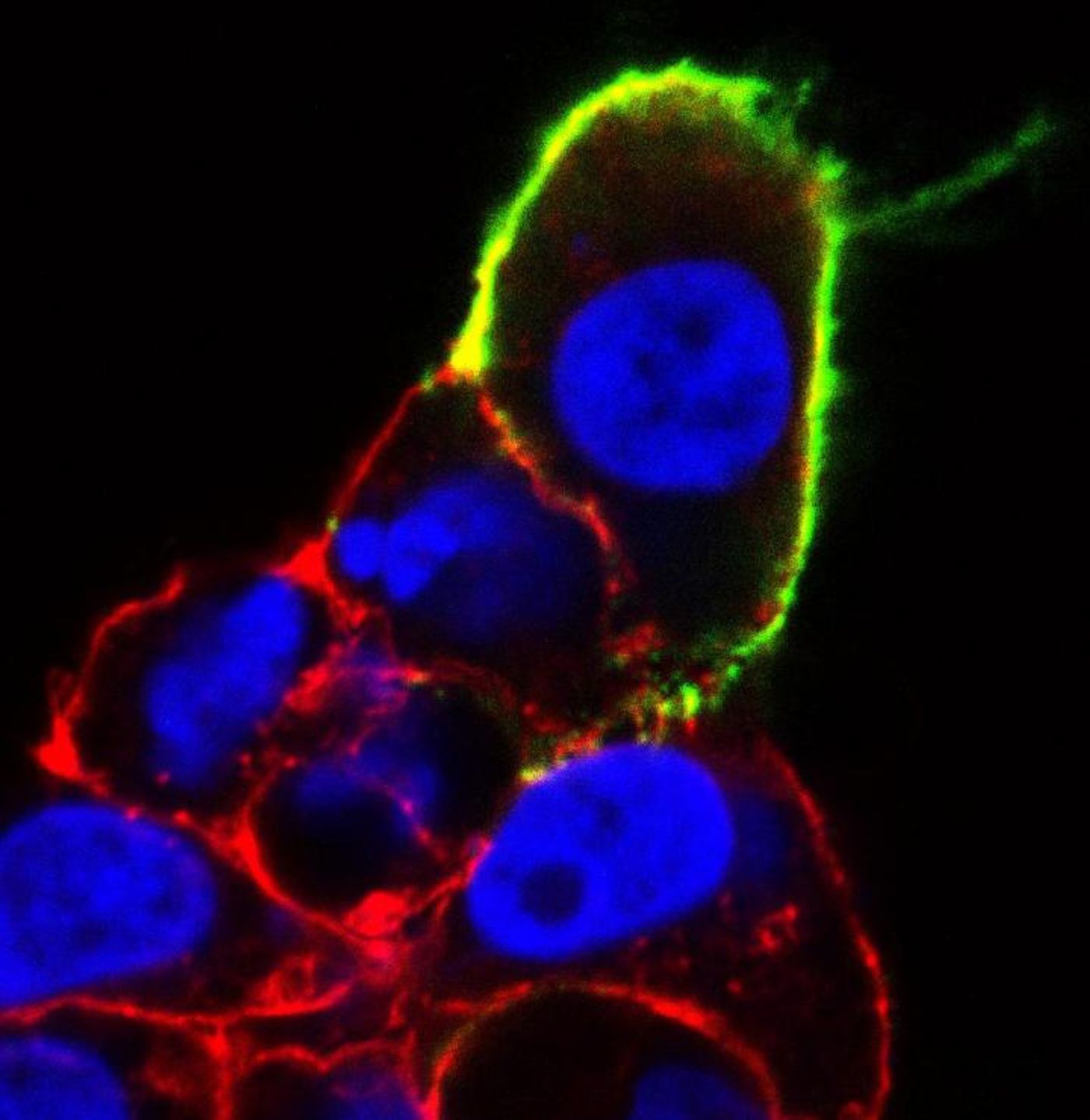 The green indicates the g protein-coupled receptor 182, which UNC researchers say could be vital in the fight against gastrointestinal cancers. / Credit: Kathleen Caron Lab, UNC