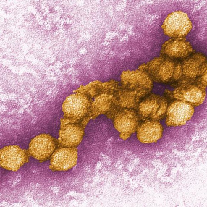 Electron micrograph of flavivirus particles.