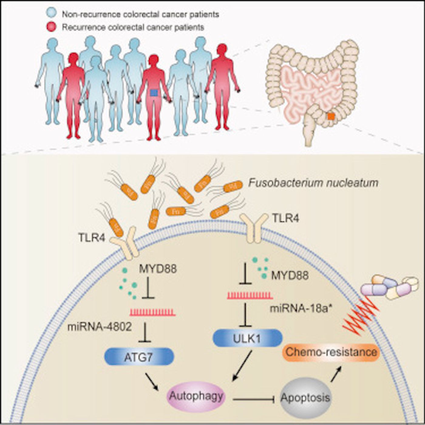 Mechanistically, F. nucleatum targeted TLR4 and MYD88 innate immune signaling and specific microRNAs to activate the autophagy pathway and alter colorectal cancer chemotherapeutic response. / Credit: Cell Yu et al 2017