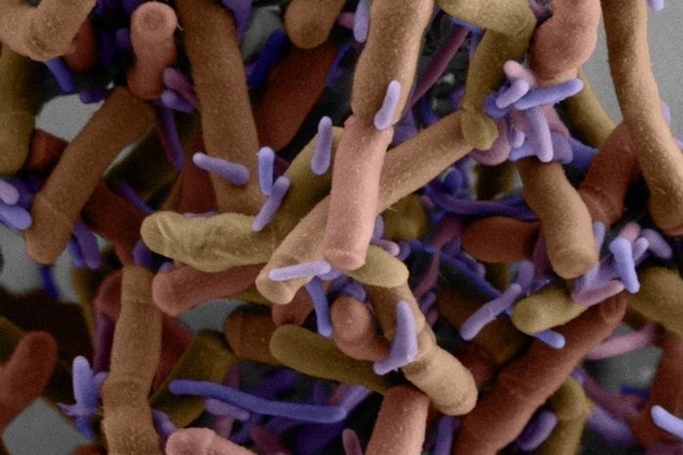 A scanning electron micrograph shows small purple Patescibacteria cells growing on the surface of much larger cells. These epibiotic bacteria are Southlakia epibionticum. / Credit: Yaxi Wang, Wai Pang Chan and Scott Braswell/University of Washington
