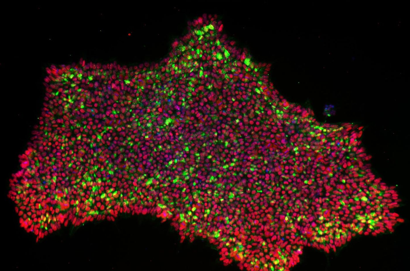 CRISPRa reprogrammed induced pluripotent stem cell colonies stained for pluripotency marker expression. / Credit: Otonkoski Lab / University of Helsinki