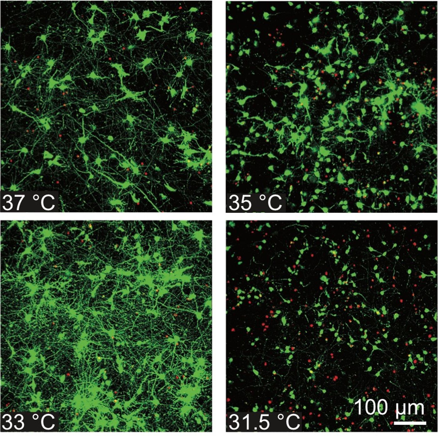  Confocal micrographs of cell populations after post-injury hypothermia treatment.  / Credit: Bill Graf / University of Wisconsin - Madison