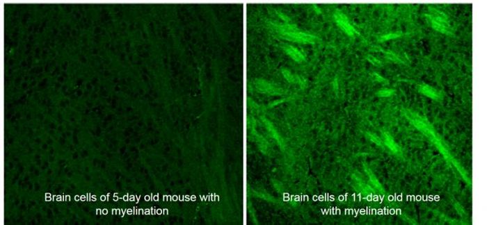 Deuterium-labeled SRS imaging highlights brain cells in developing mice rapidly put on fat during myelination. Detecting abnormal myelination could head injury and multiple sclerosis diagnostics/. Credit: Min lab/Columbia
