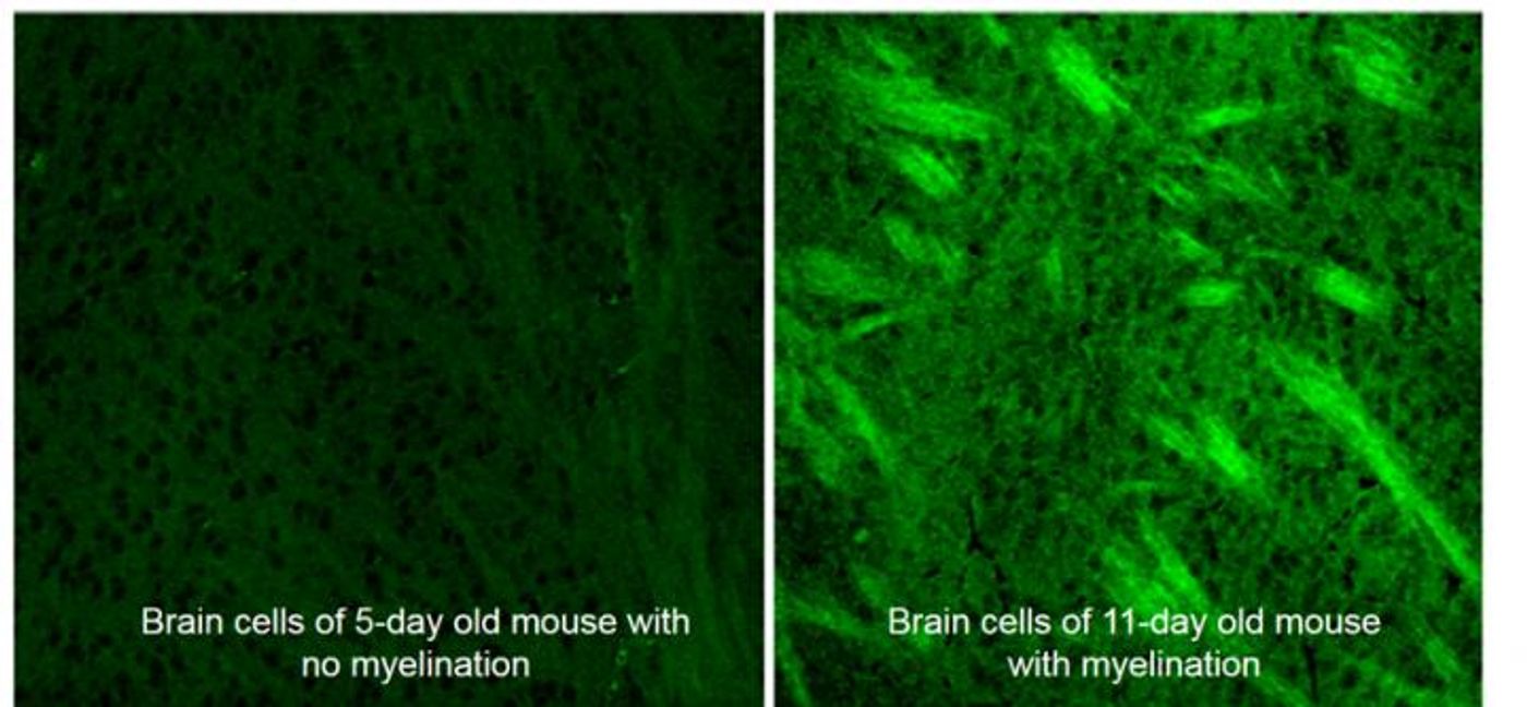 Deuterium-labeled SRS imaging highlights brain cells in developing mice rapidly put on fat during myelination. Detecting abnormal myelination could head injury and multiple sclerosis diagnostics/. Credit: Min lab/Columbia