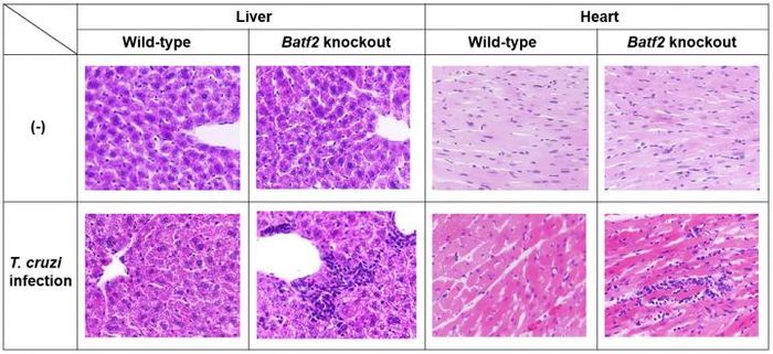 BATF2 knockout mice showed great hepatic inflammation and myocarditis. Credit: Osaka University