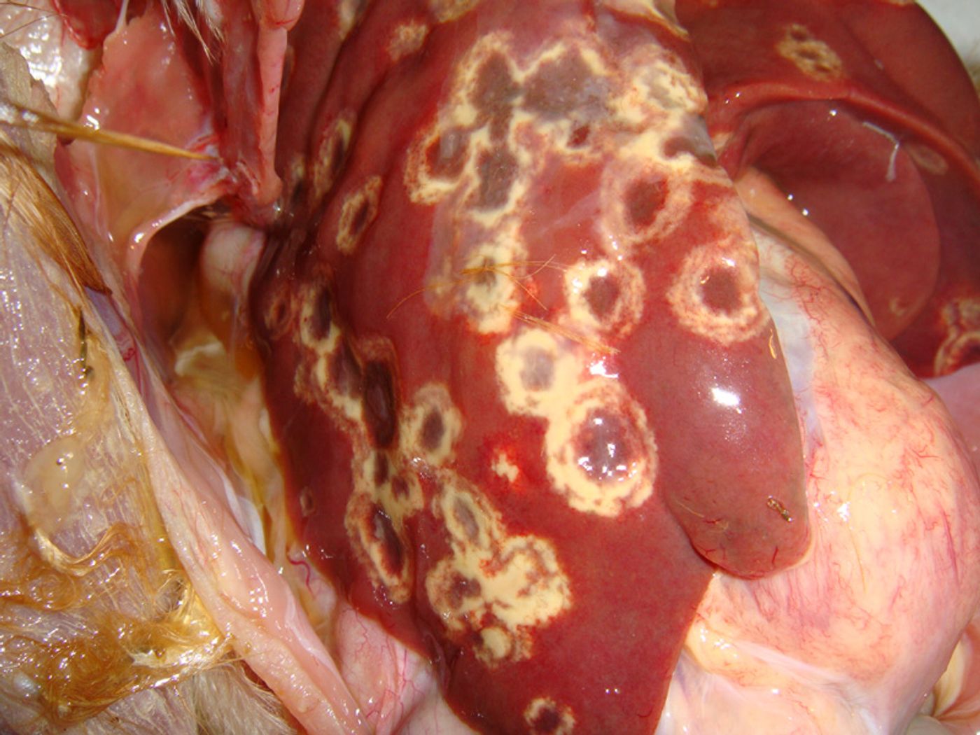 Blackhead causes "bulls-eye" lesions on the liver.