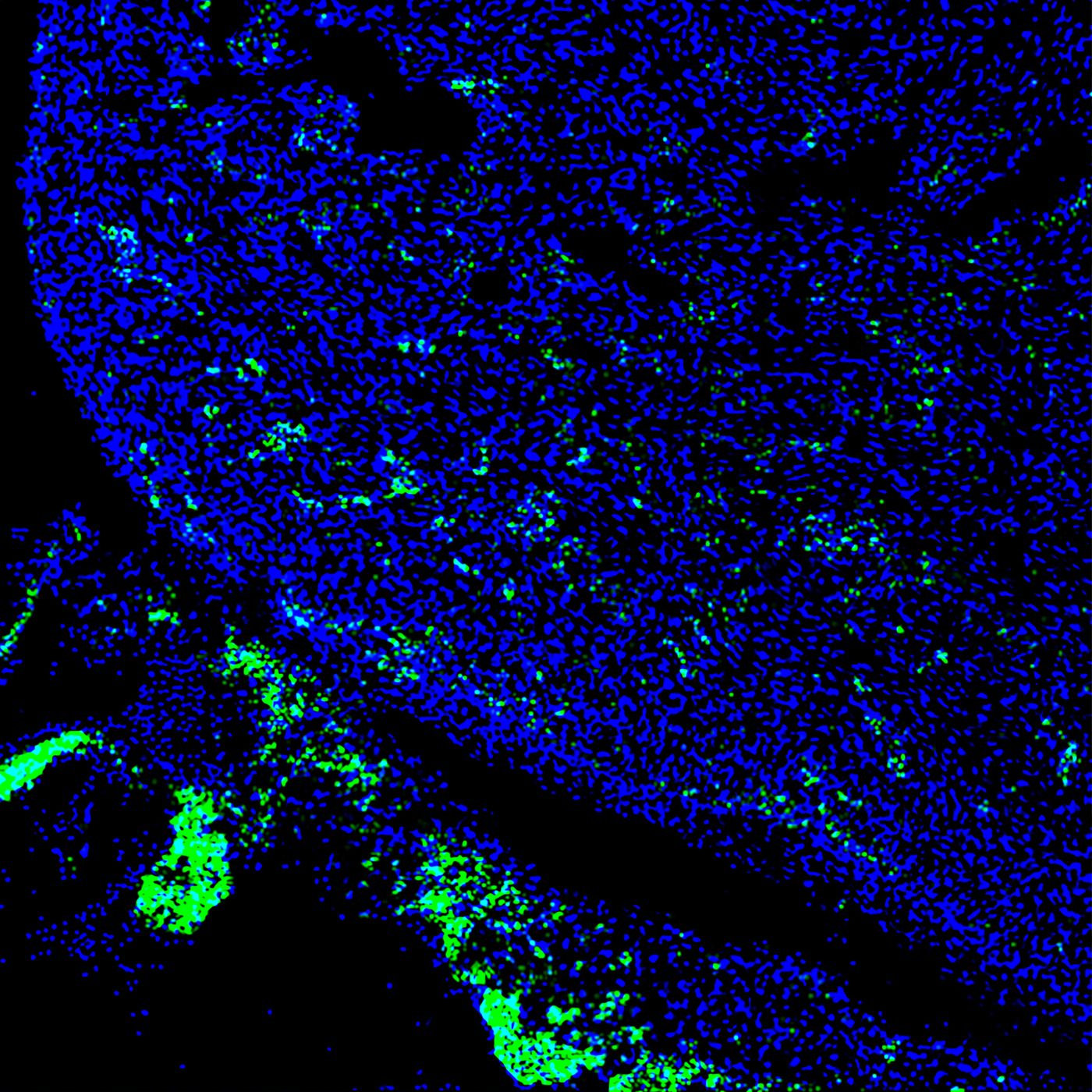 Human iPS cells (green) contributed to a developing heart of 4-week-old pig embryo. / Credit: Salk Institute