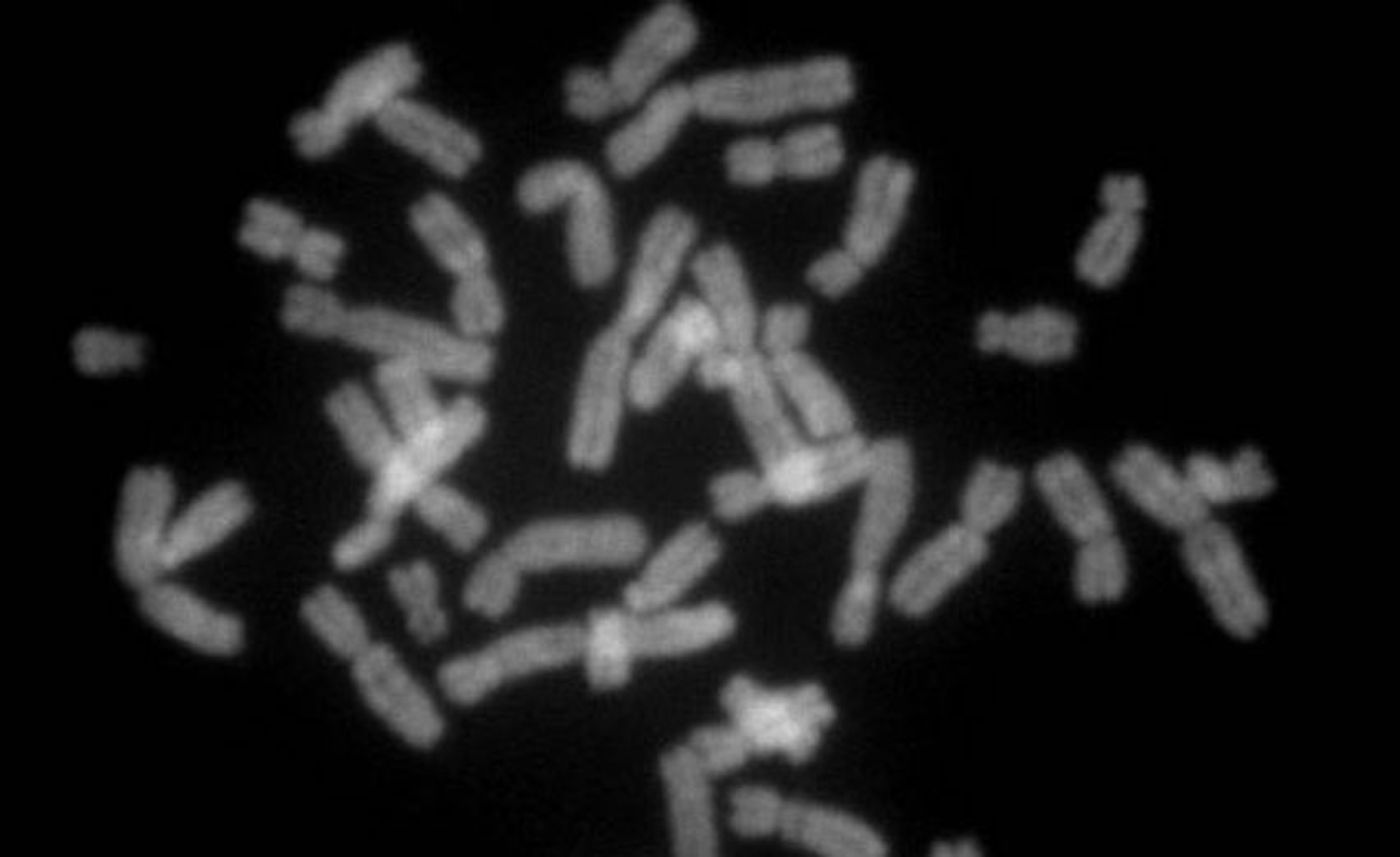 Metaphase chromosomes from a female human lymphocyte, stained with Chromomycin A3, fluorescence microscopy. / Credit: Wikimedia/Steffen Dietzel