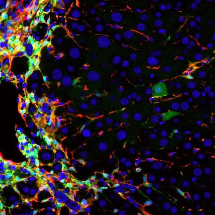 UCSF researchers have learned to generate healthy new liver cells (dark green, right side) within the livers of living mice by converting the very cells that drive liver disease (red, left side), thereby reducing liver damage and improving liver function at the same time. Image: Willenbring lab / UCSF