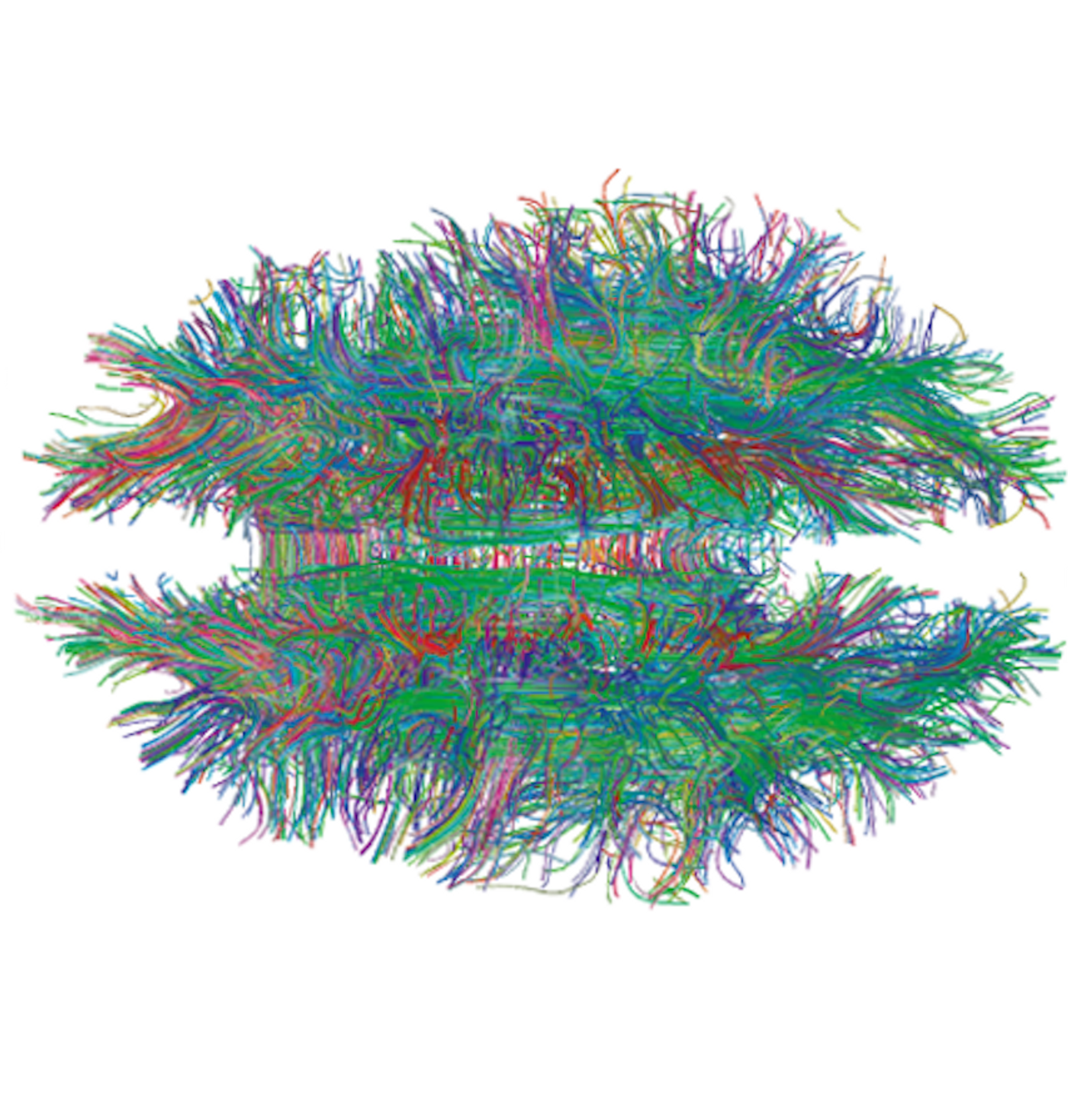 In this figure from Gigandet X et al. (2008) PLoS ONE, white matter connections in the brain are visualized by diffusion MRI Tractography