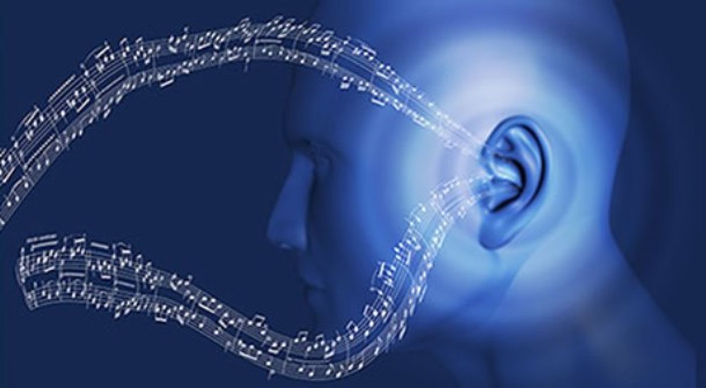 Music is such a powerful force that ~30% of CI users got a cochlear implant simply to be able to listen to music again.