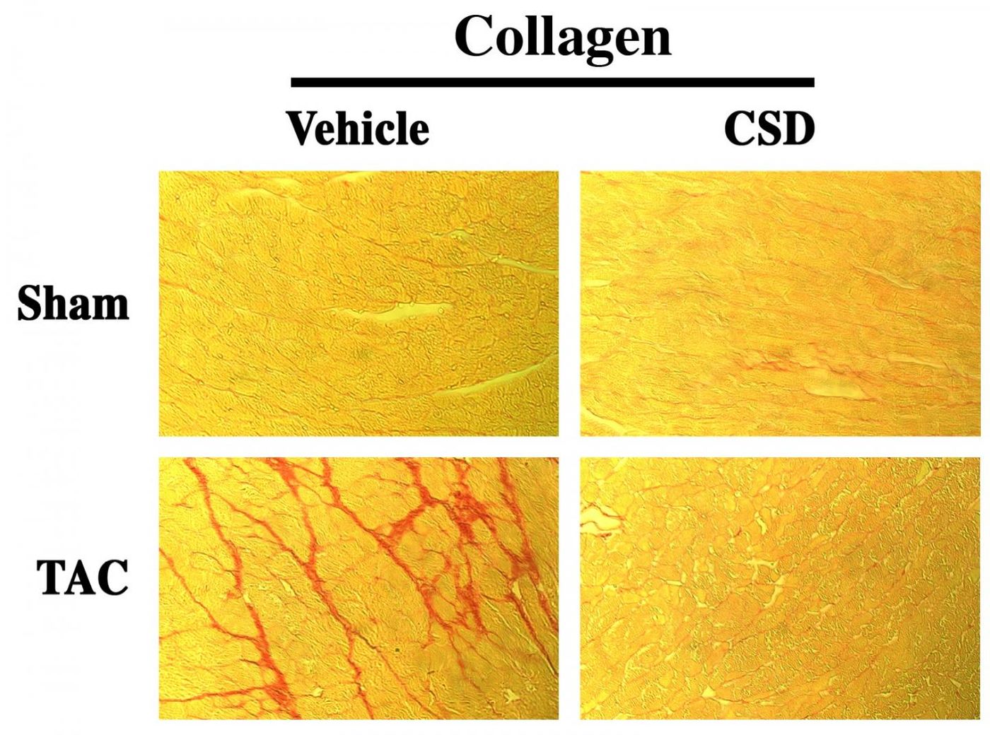 Caveolin-1 scaffolding domain (CSD) peptide reverses collagen accumulation in pressure overloaded (TAC) myocardium. Source: Dr. Hoffman and Dr. Kuppuswamy from a figure published in Laboratory Investigation