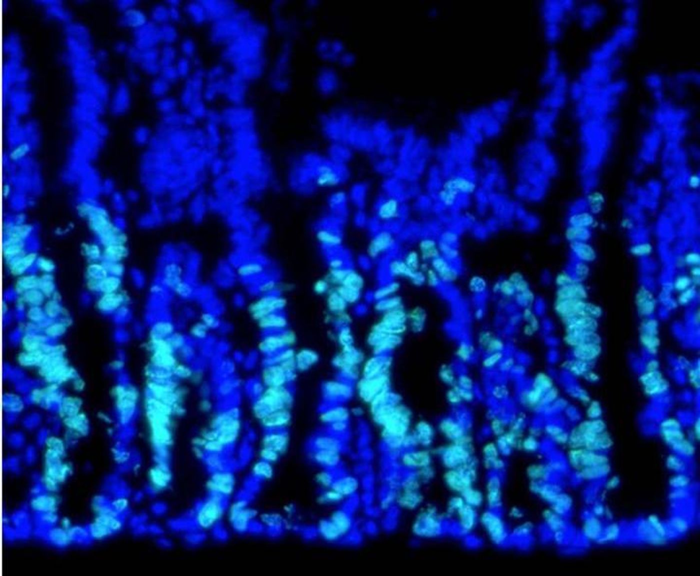 A pale-blue stain shows stem cells multiplying in a mouse's intestine. / Credit: Tontonoz lab/UCLA