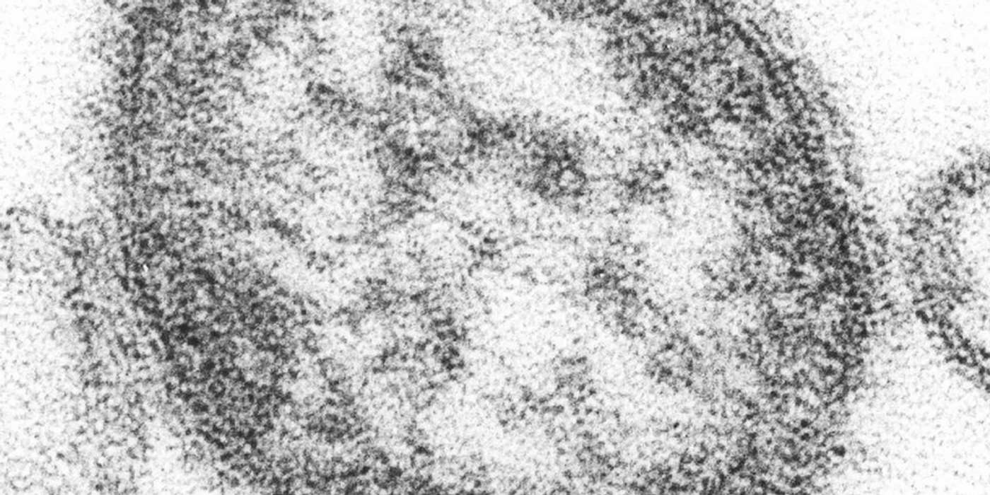 A thin-section transmission electron micrograph revealed the ultrastructural appearance of a single virus particle of measles virus. Credit: CDC Public Health Image Library
