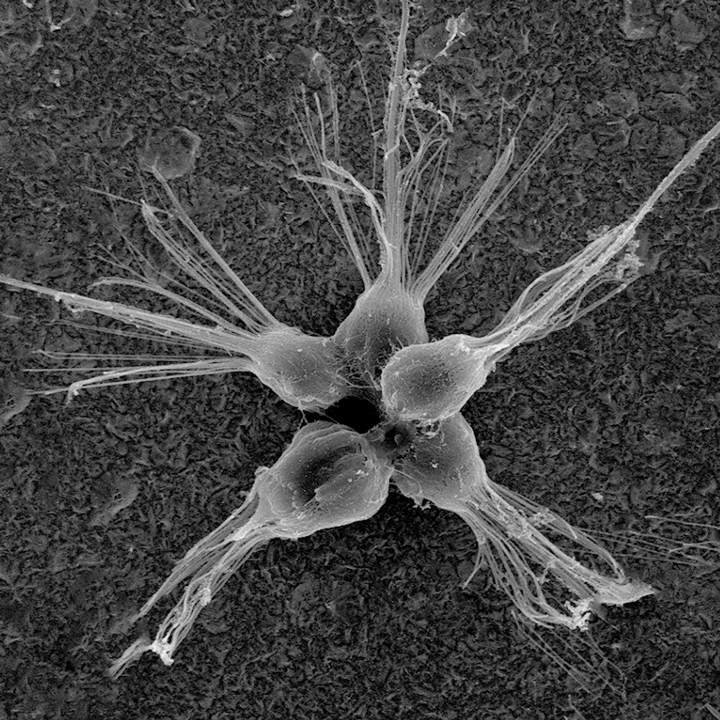 A choanoflagellate rosette colony