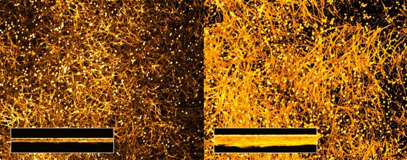 Albumin triggers fungal virulence: Candida albicans forms denser biofilms in the presence of human albumin (right) compared to its absence (left), revealing a hidden pathogenicity pathway.  Credit  Beatriz Cristóvão, Leibniz-HKI
