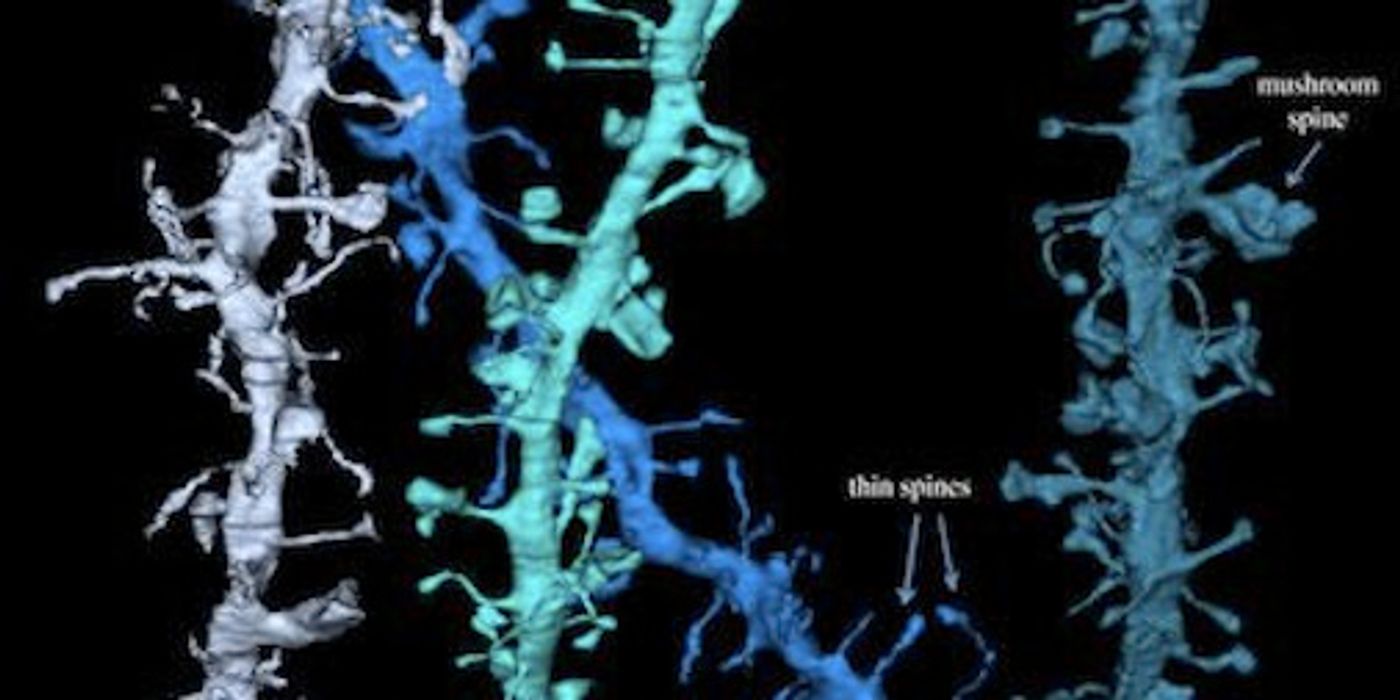 3-D reconstructions of electron microscope images of tree branch-like dendrites. At the end of the branches are cup-like structures called the spines, and in the tips of the spines are synapses. / Credit: Wisconsin Center for Sleep and Consciousness