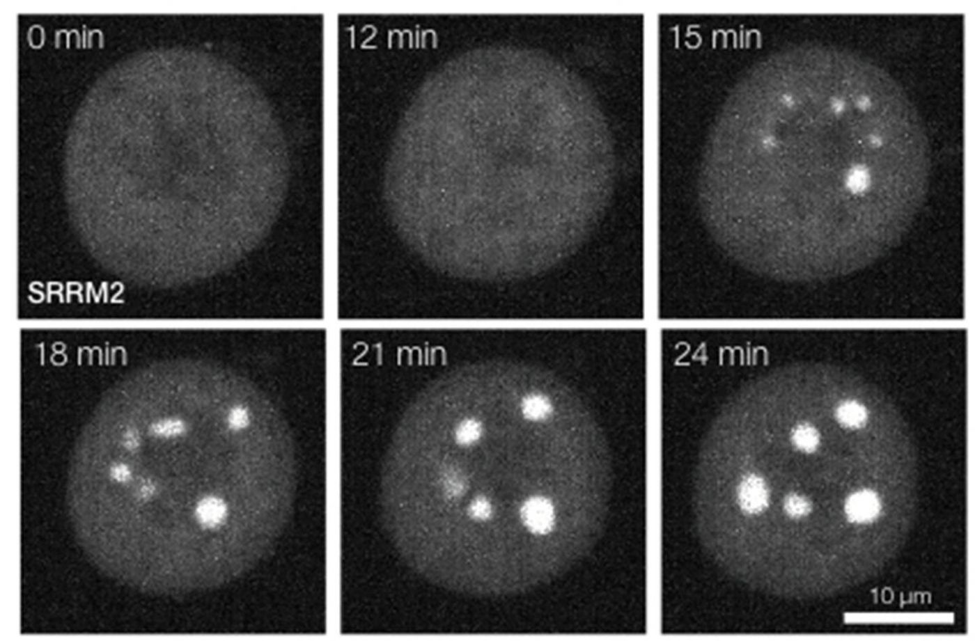 In this series of frames from a movie, phase separation of a protein is observed upon inhibiting the enzyme DYRK3 (time in min. after adding the inhibitor).  / Credit: Arpan Rai, UZH